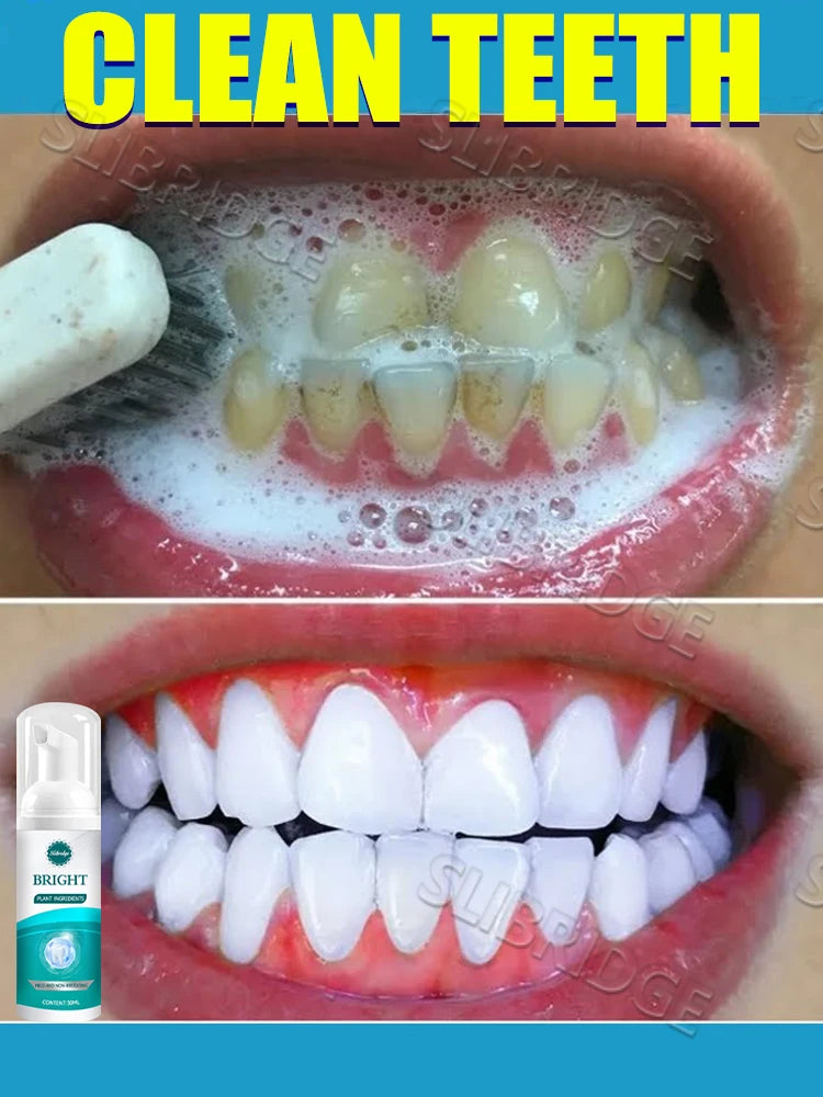 Teeth cleaning care tools, oral foam