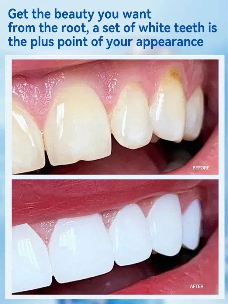 Teeth cleaning care tools, oral foam